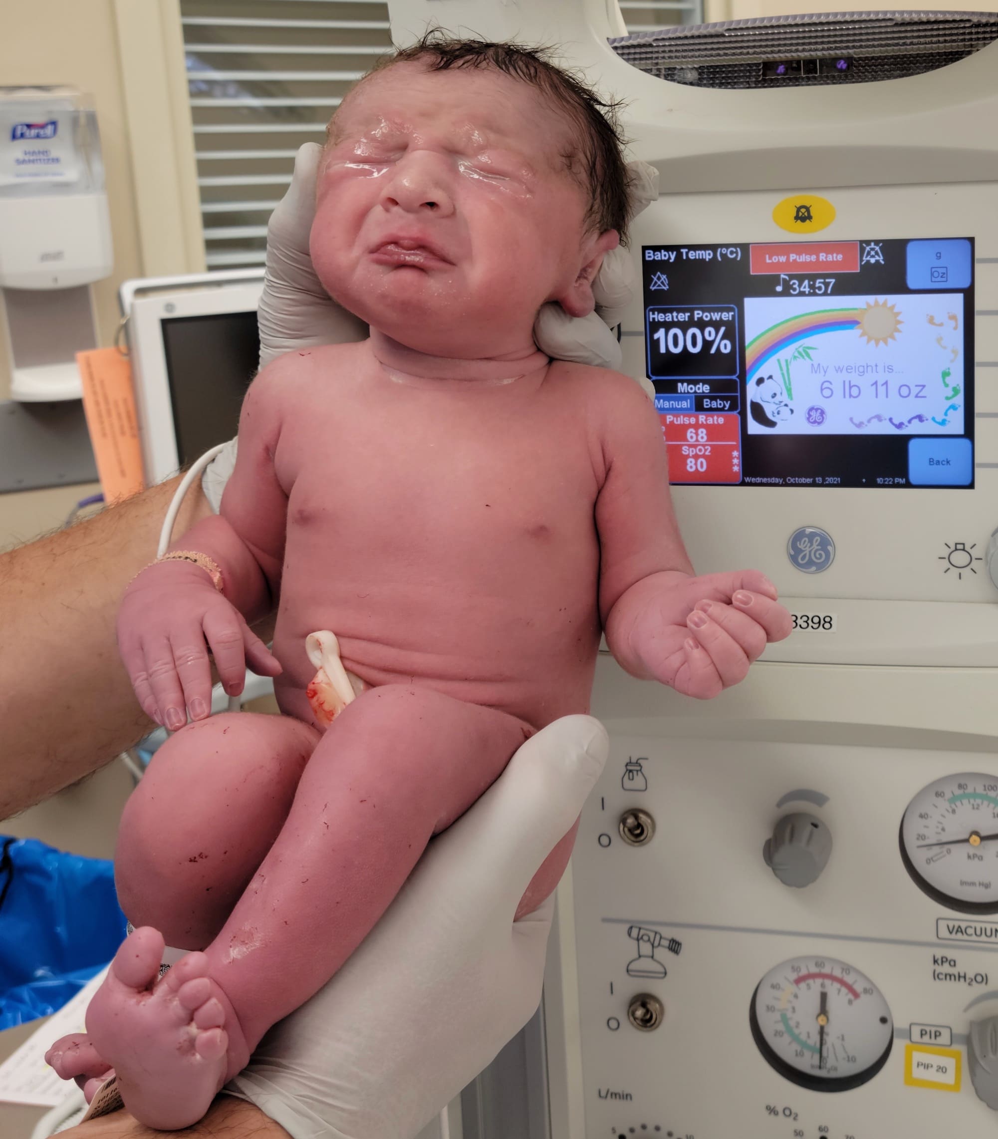 essure-reversal-baby-from-harris-mn-born-three-years-after-reversal-surgery
