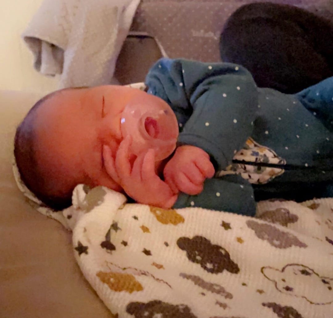 Essure-reversal-surgery-baby-from-walker-minnesotta