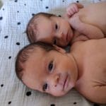 twin-girls-born-after-tubal-reversal-in-mother-with-endometrial-ablation