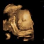 passed-our-28-week-anatomy-scan-thanks-dr-monteith