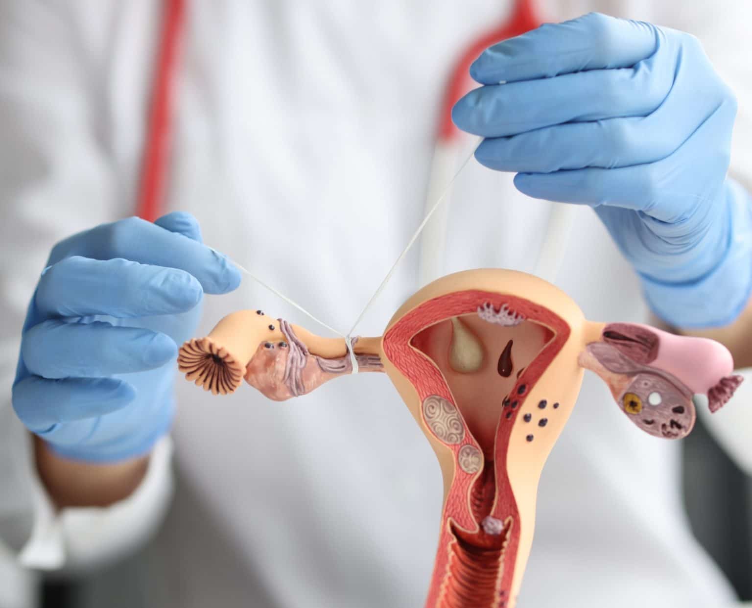 Types of Tubal Ligation, and How They Are Reversed