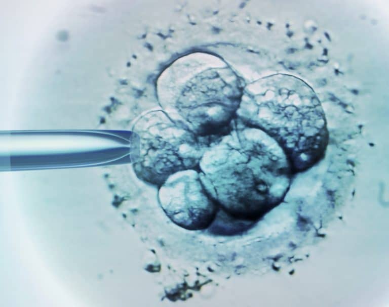 Can You Get Pregnant After Tubal Ligation Reversal Surgery?