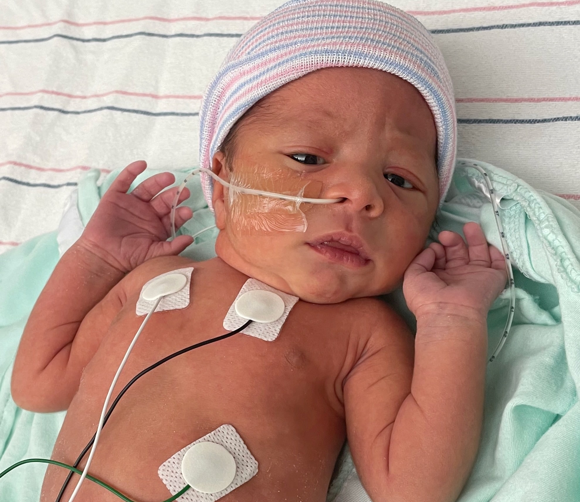 slightly-premature-tubal-reversal-baby-from-Hebron-Indiana
