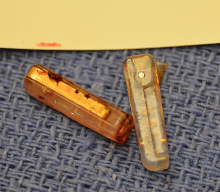 Fallopian Tube Clips Tubal Clip Tubal Ligation Explained