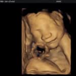 Clarksburg-Tennessee-28-weeks-pregnant-after-tubal-reversal