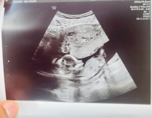 blood-test-says-we-are-having-a-boy