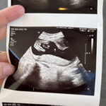 halfway-through-pregnancy-17-weeks-with-baby-boy