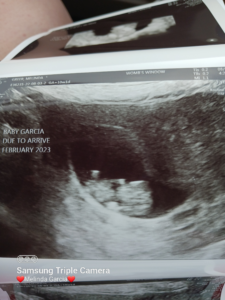 second-tubal-reversal-baby-wilmington-nc