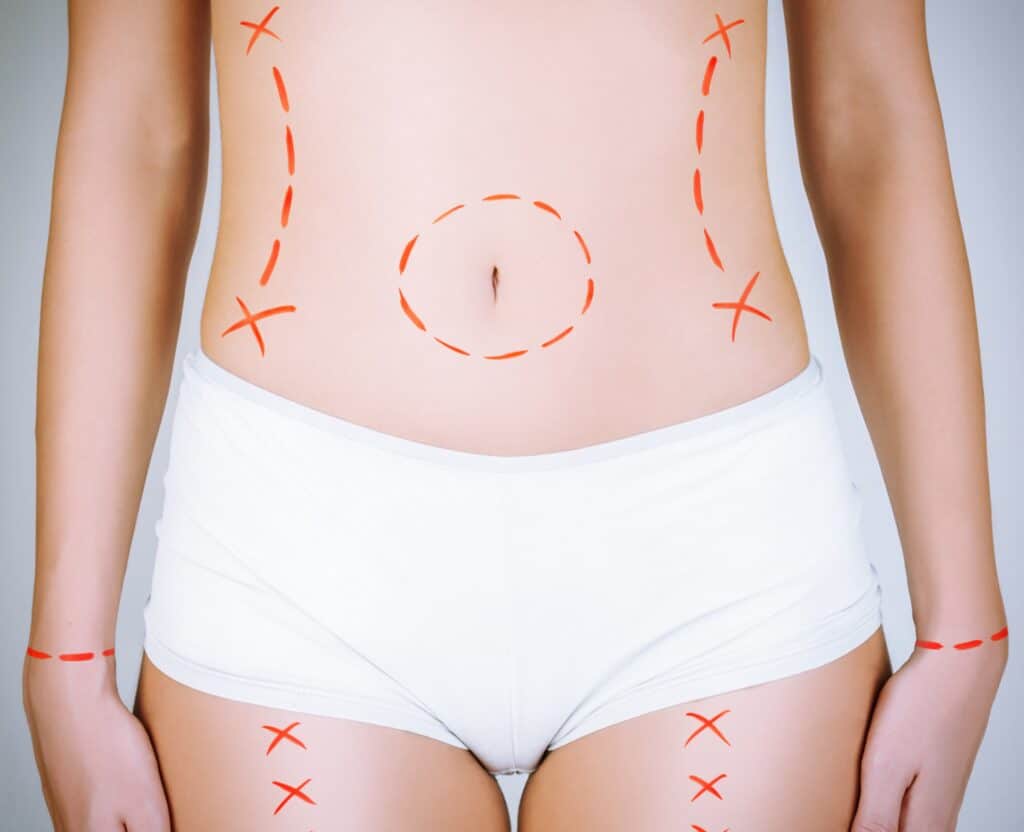 Medical Reasons For Tubal Reversal Surgery