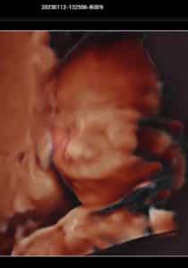 being-ama-does-not-mean-you-wont-have-a-baby-siox-city-iowa