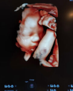 we-cant-wait-to-meet-our-reversal-baby-North-Wilkesboro-NC