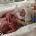 baby-from-santa-ana-california-born-early-after-reversal