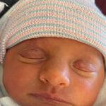 Edinburg-Virginia-baby-born-after-reversal-of-burned-tubal-ligation
