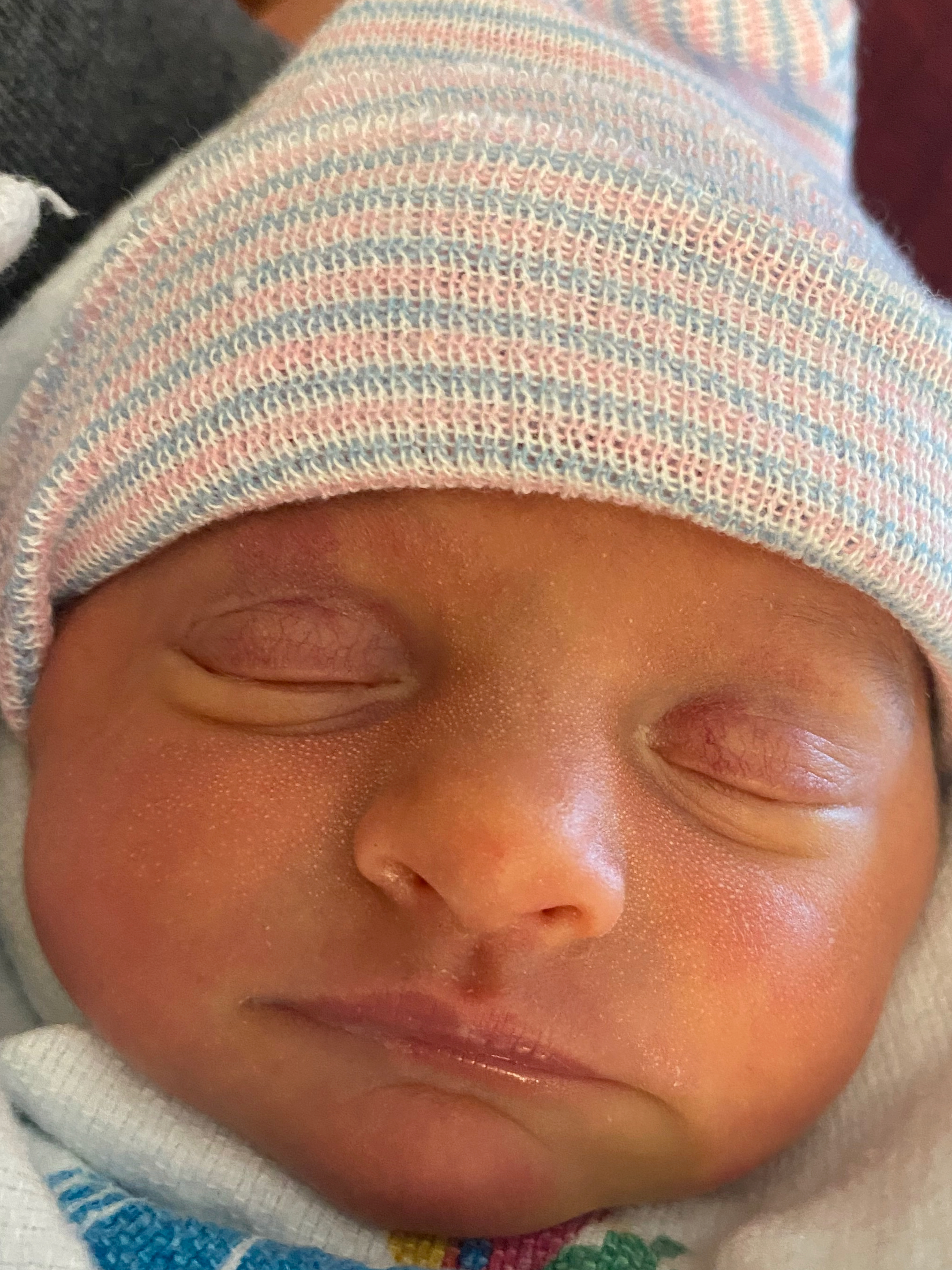 Edinburg-Virginia-baby-born-after-reversal-of-burned-tubal-ligation