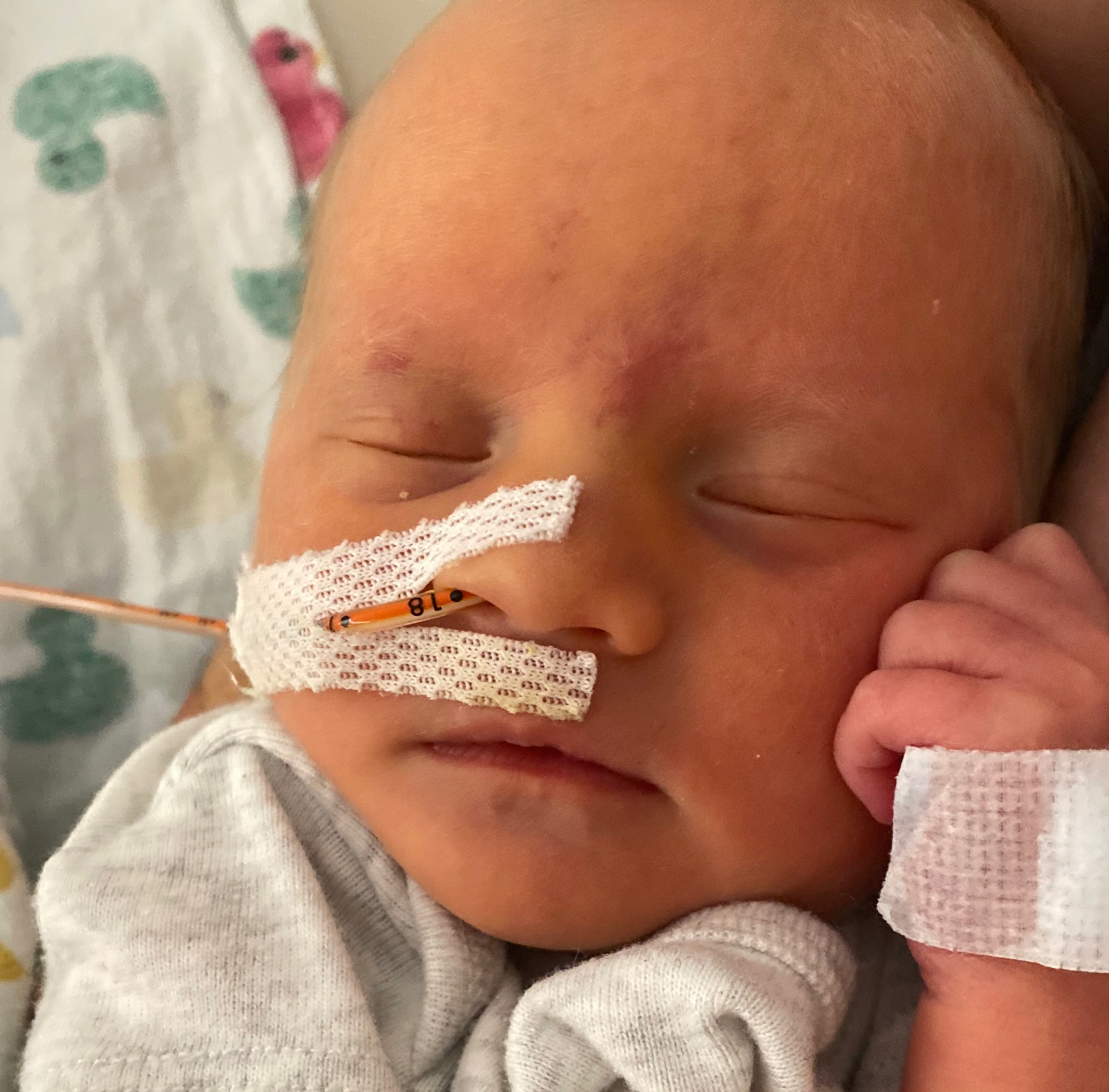 Second-tubal-reversal-baby-is-here-a-little-early-but-doing-great