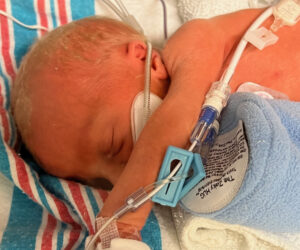 reversing-tied-cut-tubes-meet-james-born-after-tubal-ligation-reversal