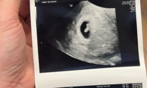 quick-pregnancy-for-this-sharps-chapel-tn-mom-after-removing-tubal-rings