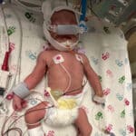 tubal-reversal-baby-from-chicago-illinois-born-at-32-weeks-gestation