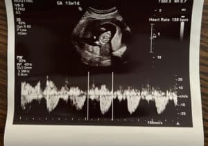 passed-our-NIPT-screening-test-having-a-baby-girl