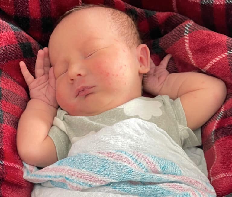 Tubal Ligation Reversal Wisconsin Visit Dr Monteith! A Personal Choice