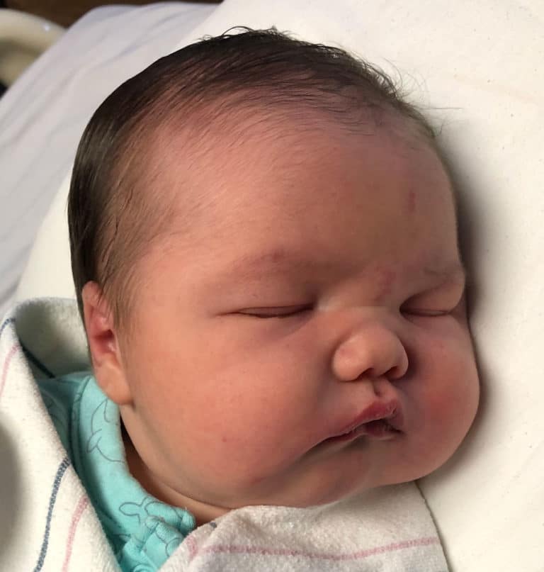 Iowa Tubal Ligation Reversal Surgery A Personal Choice Reversal Center!