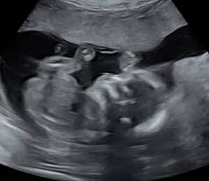 reversing-burned-tubes-Poteau-OK