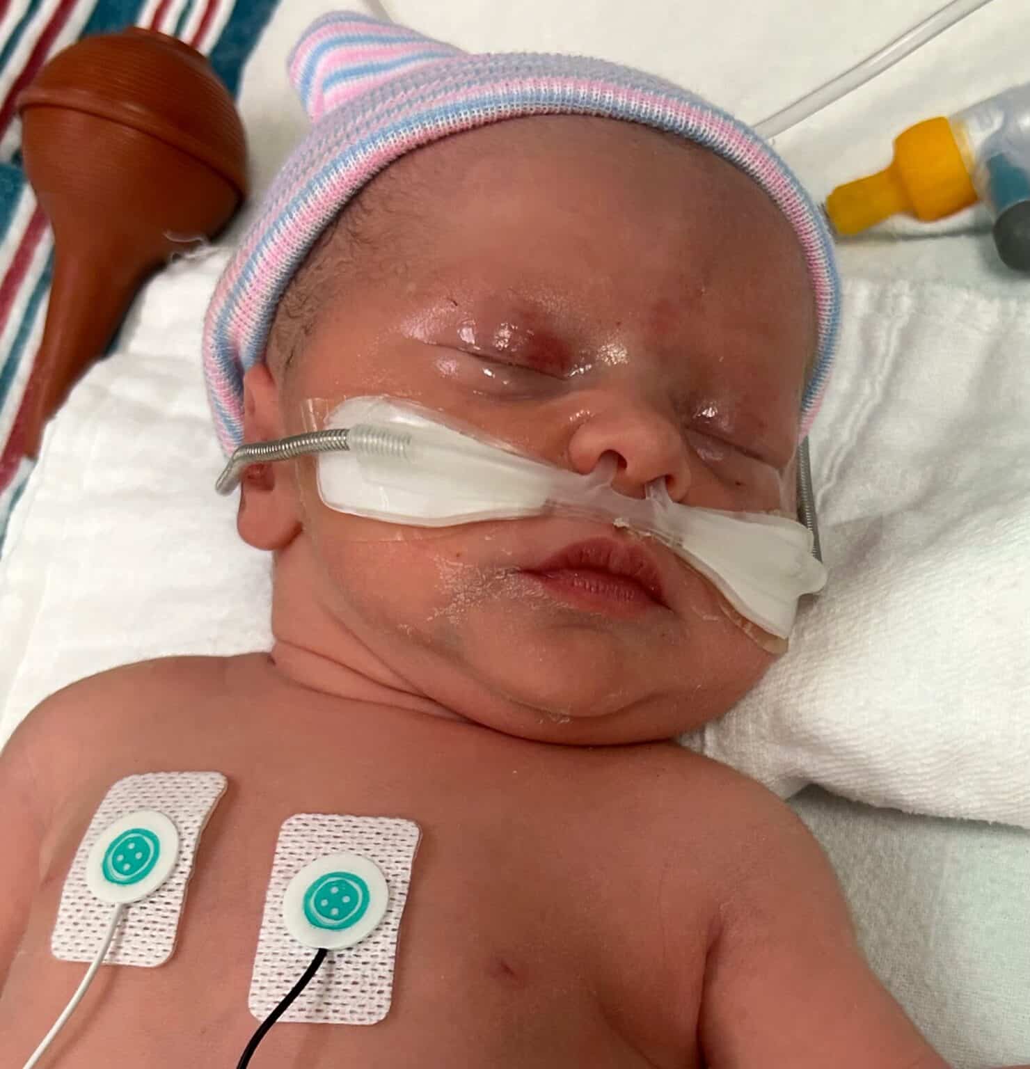 Tubal Reversal Testimonials Pregnancy After Reversal IVF Success