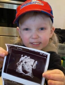 tubal-reversal-mount-vernon-Ohio-big-brother-holding-picture