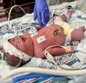 canton-ohio-miracle-tubal-reversal-baby