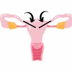 surigcal-incisions-made-during-essure-reversal-surgery