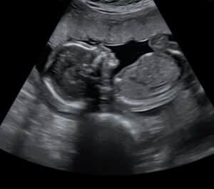 second-last-reversal-baby-mocksville-nc