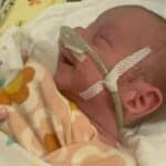 tubal-reversal-baby-from-goshen-indiana-born-at-28-weeks-gestation