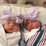 twins-after-reversing-tubal-clips-McMinnville-TN