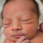 tubal-reversal-Springfield-MA