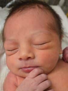 tubal-reversal-Springfield-MA