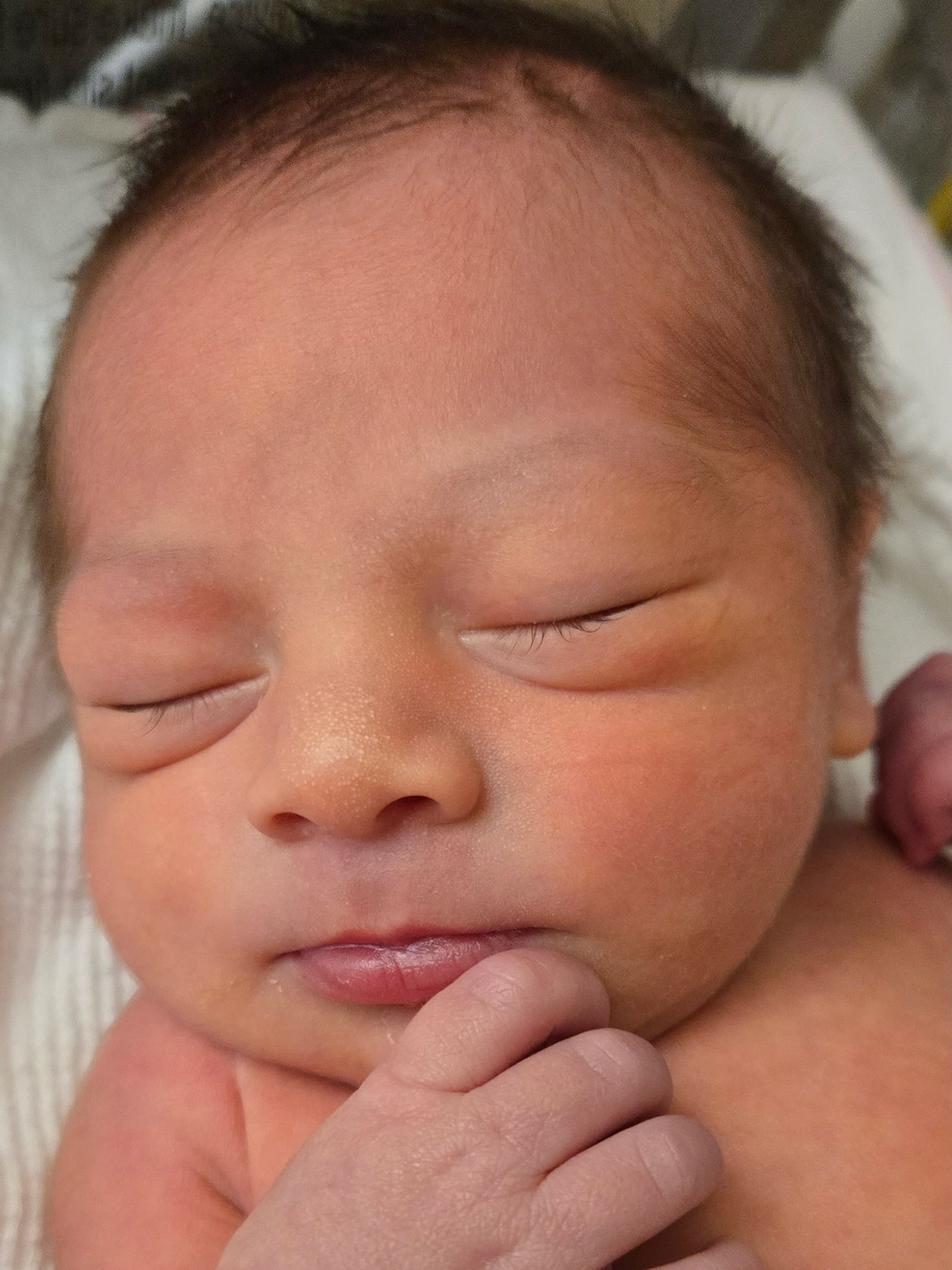 tubal-reversal-Springfield-MA
