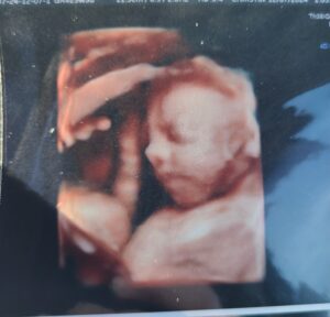 28-weeks-pregnant-franklin-ohio