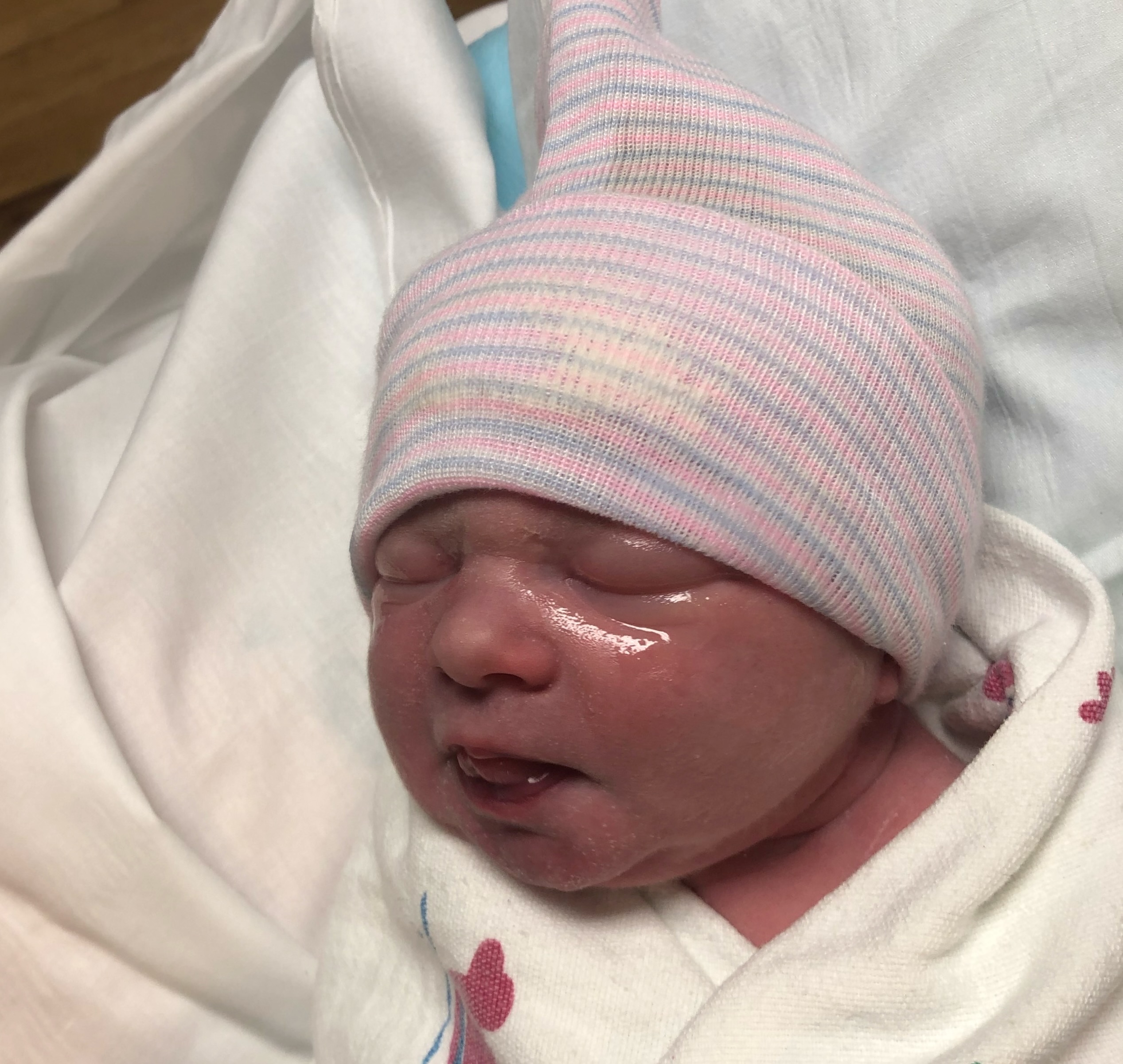 tubal-reversal-sioux-city-iowa-tubal-clips-reversal-surgery
