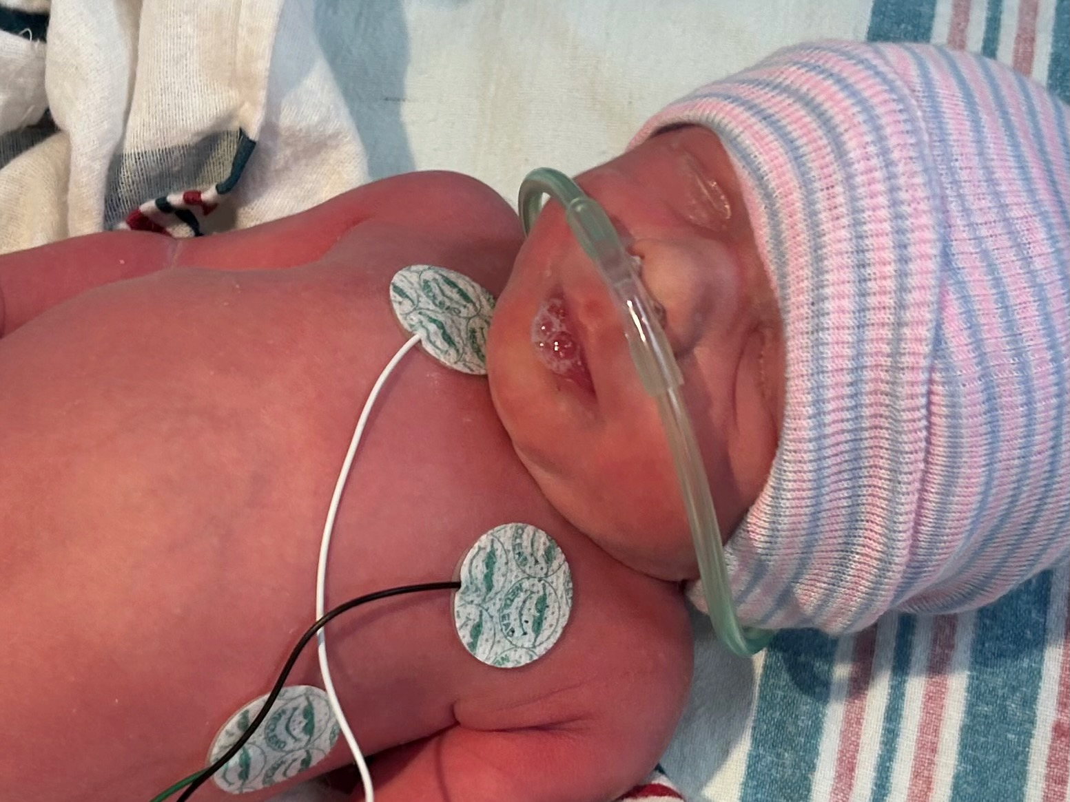 tubal-reversal-surgery-Arkansas