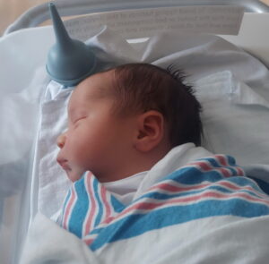 Adiana-tubal-ligation-reversal-Florence-Kentucky