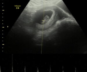 reversing-burned-tubes-millersville-maryland
