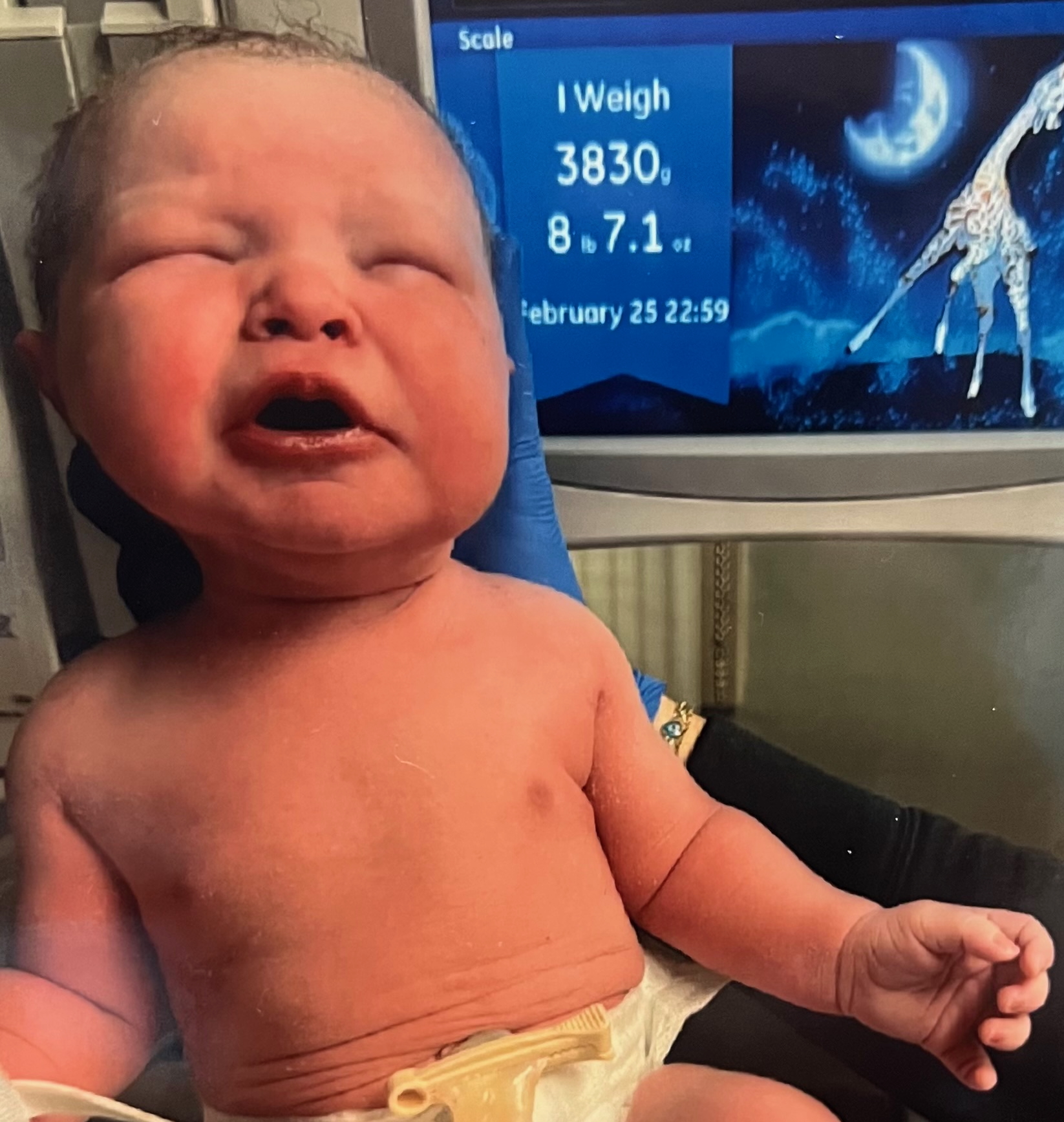 Essure-reversal-warren-texas-essure-reversal-surgery-provides-healthy-baby-girl