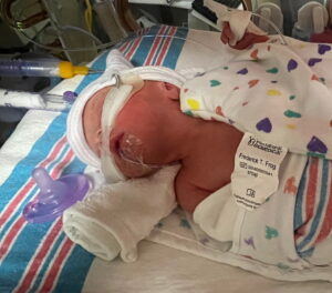 morganton-nc-tubal-ligation-reversal-surgery-couples-last-baby
