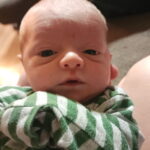 tubal-reversal-Madison-Indiana-tubal-clip-reversal-surgery