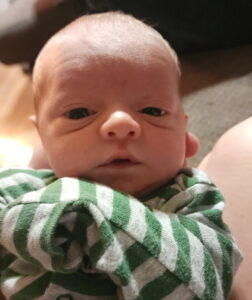 tubal-reversal-Madison-Indiana-tubal-clip-reversal-surgery