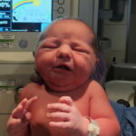 tubal-ligation-reversal-surgery-north-dakota
