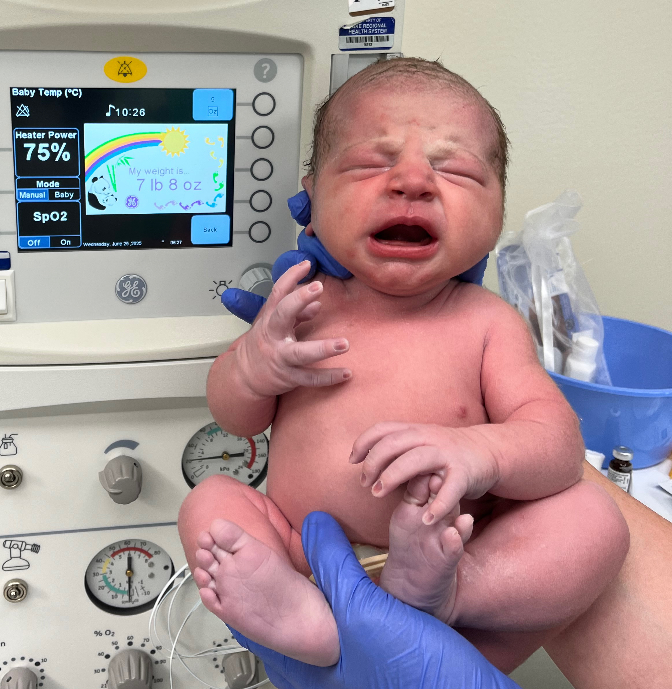 Essure-reversal-procedure-lebanon-MO