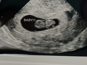 Ultrasound, Kannapolis, BC