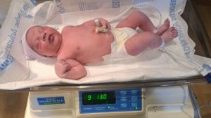 Longs, SC, Tubal Reversal