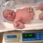 Longs, SC, Tubal Reversal